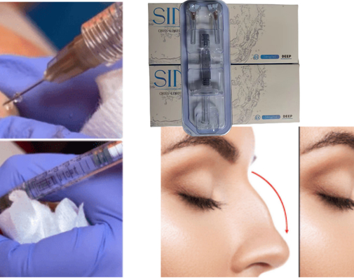 Iniezione di Acido Ialuronico per il Viso, Riempitore Dermico per Labbra CE MSDS ISO