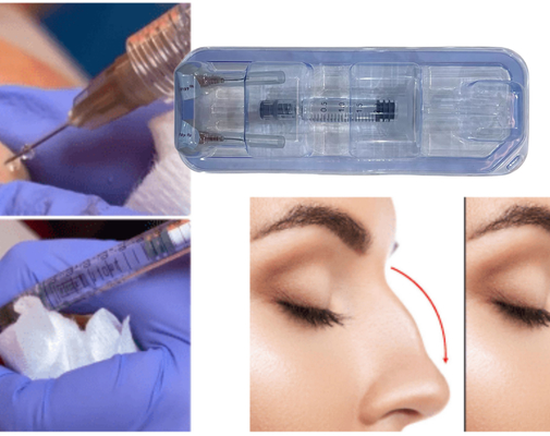 L' FDA ha approvato l' iniezione di gel di acido ialuronico per i glutei.