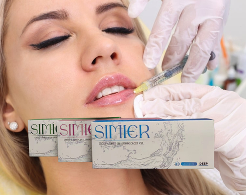 Iniezione di Acido Ialuronico 5 ml 30 mg/ ml Connessione incrociata