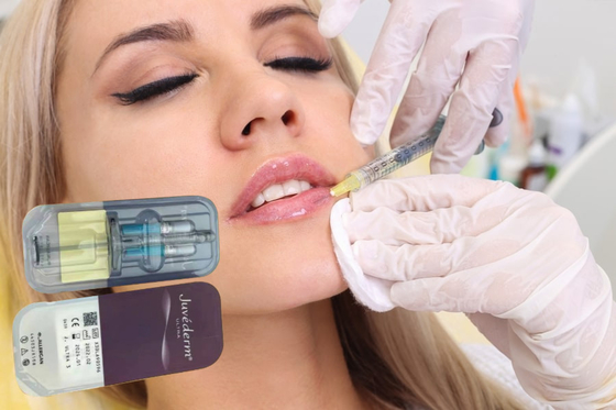 Riempitivi Acido ialuronico Gel 5 ml Riempitivo per labbra Iniezioni Riempitivo per la pelle Iniettabile