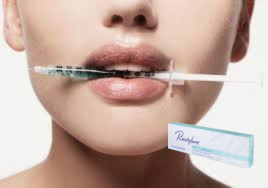 27G filler a base di acido ialuronico per linee di marionetta 1 ml filler a linea profonda con Lido