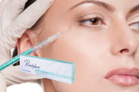 27G filler a base di acido ialuronico per linee di marionetta 1 ml filler a linea profonda con Lido