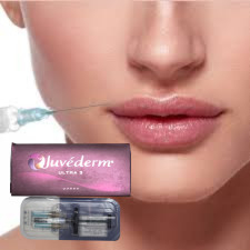 Iniezioni di caricatore cutaneo di acido ialuronico per viso e labbra Juvederm Ultra 3 12 mesi