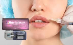 1 ml/ scatola Riempitivi per labbra iniettabili mento guance Riempitivo HA incrociato