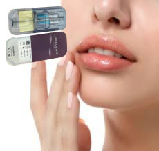 2 X 1 ml di Juvederm Ultra 4 Iniezioni di Riempitore Dermico Iniezioni di Riempitore Labbra