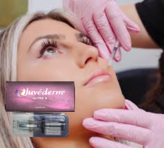 2x1 ml di HA Dermal Filler Cheekbone Chin Contouring Injections