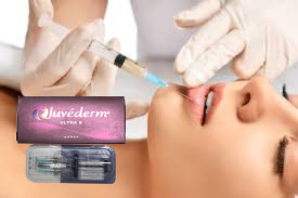 2x1 ml di HA Dermal Filler Cheekbone Chin Contouring Injections