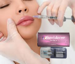 2 X 1 ml di Juvederm Ultra 4 Iniezioni di Riempitore Dermico Iniezioni di Riempitore Labbra