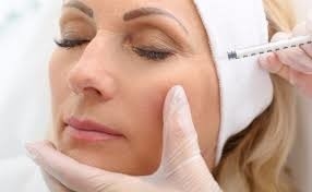 Rughe lisce Riempitore cutaneo iniettabile Acido ialuronico Juvederm Ultra 3 2*1ml