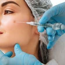 Rughe lisce Riempitore cutaneo iniettabile Acido ialuronico Juvederm Ultra 3 2*1ml