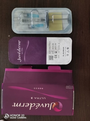 Rughe lisce Riempitore cutaneo iniettabile Acido ialuronico Juvederm Ultra 3 2*1ml